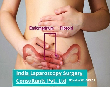 India Laparoscopy Surgery Consultants Pvt. Ltd