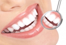 Kb Village Dental - Teeth Whitening