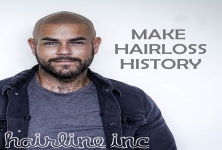 Hairline Inc Ltd.